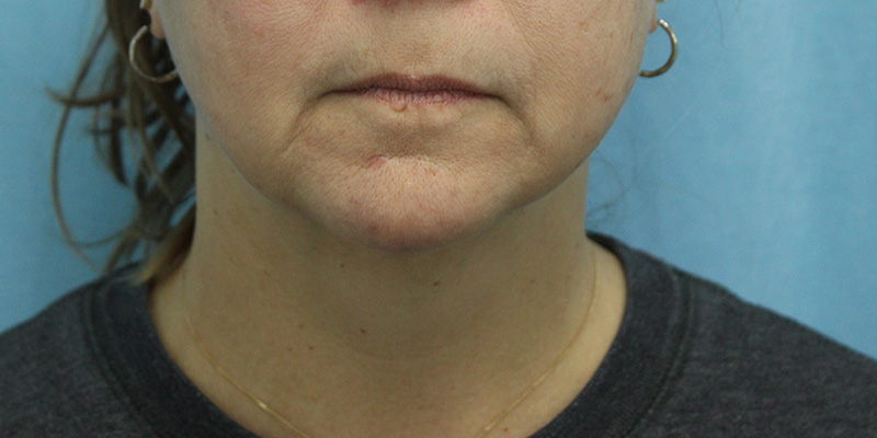 Default alt text for 01 (7)