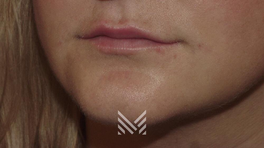 Default alt text for watermark (26)